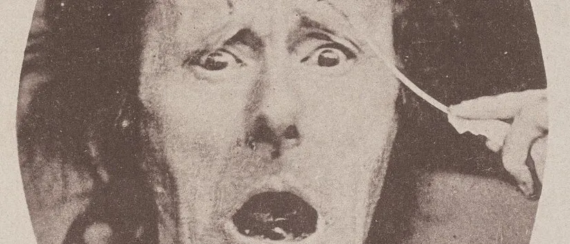 Oval nineteenth-century photograph of a man's face with raised brows, wide eyes and open mouth as electrodes are held to it